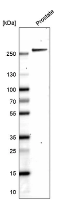 Western blot analysis in human prostate tissue.