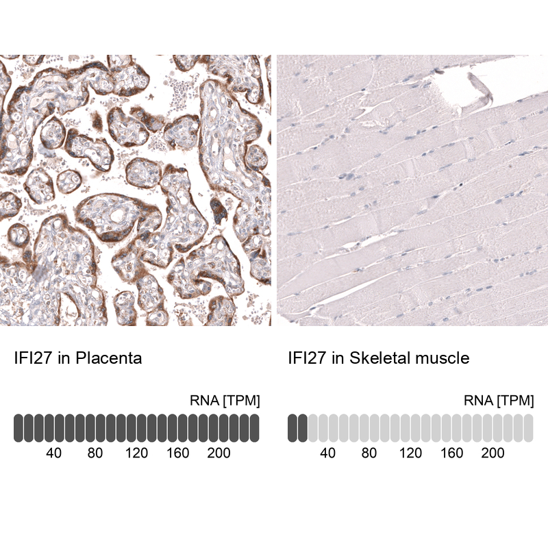 Anti-IFI27 Antibody