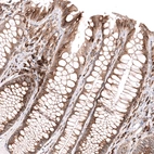 Immunohistochemical staining of human colon shows moderate cytoplasmic positivity in glandular cells.