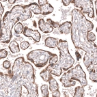 Immunohistochemical staining of human placenta shows strong cytoplasmic positivity in trophoblastic cells.