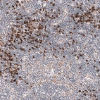 Immunohistochemical staining of human lymph node shows strong cytoplasmic positivity in lymphoid cells.