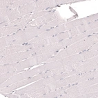 Immunohistochemical staining of human skeletal muscle shows no positivity in myocytes as expected.