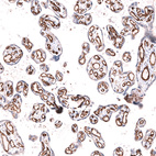 Immunohistochemical staining of human placenta shows strong membranous positivity in endothelial cells.