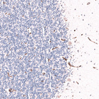 Immunohistochemical staining of human cerebellum shows moderate membranous positivity in endothelial cells.