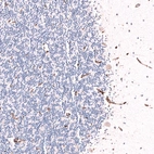 Immunohistochemical staining of human cerebellum shows moderate membranous positivity in endothelial cells.
