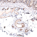 Immunohistochemical staining of human colon shows strong membranous positivity in endothelial cells.