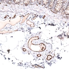 Immunohistochemical staining of human colon shows strong membranous positivity in endothelial cells.