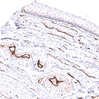 Immunohistochemical staining of human cervix, uterine shows strong membranous positivity in endothelial cells.