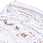 Immunohistochemical staining of human cervix, uterine shows strong membranous positivity in endothelial cells.