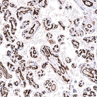 Immunohistochemical staining of human placenta shows strong membranous positivity in endothelial cells.