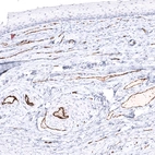 Immunohistochemical staining of human cervix, uterine shows strong membranous positivity in endothelial cells.
