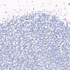 Immunohistochemical staining of human cerebellum shows strong membranous positivity in endothelial cells.