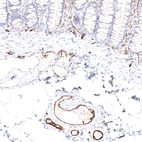 Immunohistochemical staining of human colon shows strong membranous positivity in endothelial cells.