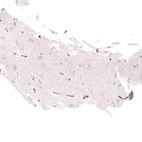 Immunohistochemical staining of human cerebral cortex shows moderate membranous positivity in endothelial cells.