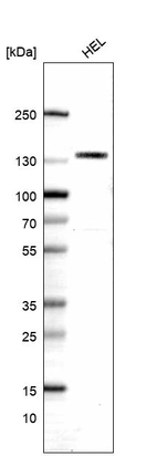 Western blot analysis in human cell line HEL.
