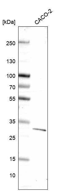Anti-DKK1 Antibody