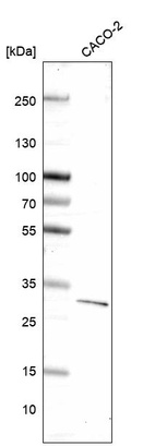 Anti-DKK1 Antibody