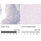 Anti-LAG3 Antibody