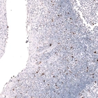Immunohistochemical staining of human tonsil shows strong cytoplasmic positivity in non-germinal center cells and germinal center cells.