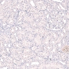 Immunohistochemical staining of human kidney shows no positivity in cells in tubules and cells in glomeruli.