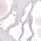 Immunohistochemical staining of human prostate shows no positivity in glandular cells and smooth muscle cells as expected.