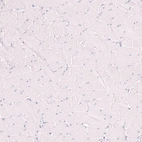 Immunohistochemical staining of human skeletal muscle shows no positivity in myocytes as expected.