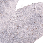 Immunohistochemical staining of human tonsil shows strong cytoplasmic positivity in a subset of non-germinal center cells.