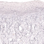 Immunohistochemical staining of human uterine cervix shows no positivity in squamous epithelial cells as expected.