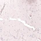 Immunohistochemical staining of human skeletal muscle shows no positivity in myocytes as expected.