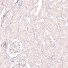 Immunohistochemical staining of human kidney shows no positivity in cells in tubules as expected.