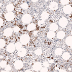 Immunohistochemical staining of human bone marrow shows strong cytoplasmic positivity in hematopoietic cells.