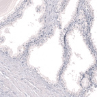 Immunohistochemical staining of human prostate shows no positivity in glandular cells as expected.