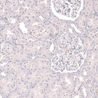 Immunohistochemical staining of human kidney shows no positivity in cells in tubules and glomeruli as expected.