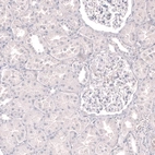 Immunohistochemical staining of human kidney shows no positivity in cells in tubules and glomeruli as expected.