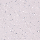 Immunohistochemical staining of human skeletal muscle shows no positivity in myocytes as expected.