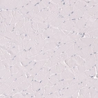 Immunohistochemical staining of human skeletal muscle shows no positivity in myocytes as expected.