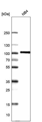 Western blot analysis in human cell line NB4.