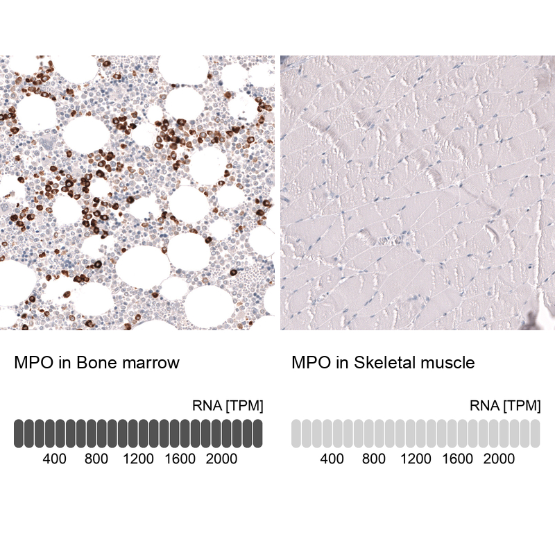 Anti-MPO Antibody