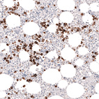 Immunohistochemical staining of human bone shows strong cytoplasmic positivity in hematopoietic cells.