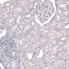 Immunohistochemical staining of human kidney shows no positivity in cells in tubules and glomerulus as expected.