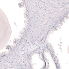 Immunohistochemical staining of human prostate shows no positivity in glandular cells as expected.