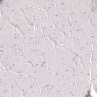 Immunohistochemical staining of human skeletal muscle shows no positivity in myocytes as expected.