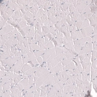 Immunohistochemical staining of human skeletal muscle shows no positivity in myocytes as expected.