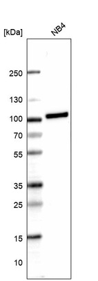 Western blot analysis in human cell line NB4.