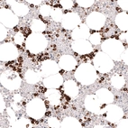 Immunohistochemical staining of human bone marrow shows strong cytoplasmic positivity in hematopoietic cells.