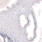 Immunohistochemical staining of human prostate shows no positivity in glandular cells as expected.