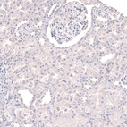 Immunohistochemical staining of human kidney shows no positivity in cells in tubules and glomerulus as expected.