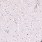 Immunohistochemical staining of human skeletal muscle shows no positivity in myocytes as expected.