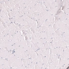 Immunohistochemical staining of human skeletal muscle shows no positivity in myocytes as expected.