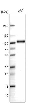 Western blot analysis in human cell line NB4.